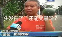 頭發(fā)白了，還能變黑嗎？醫(yī)師的答案出人意料